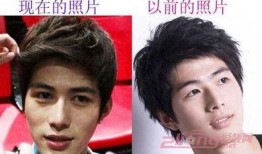 油腻男星整容爆料视频,视频爆料引发热议